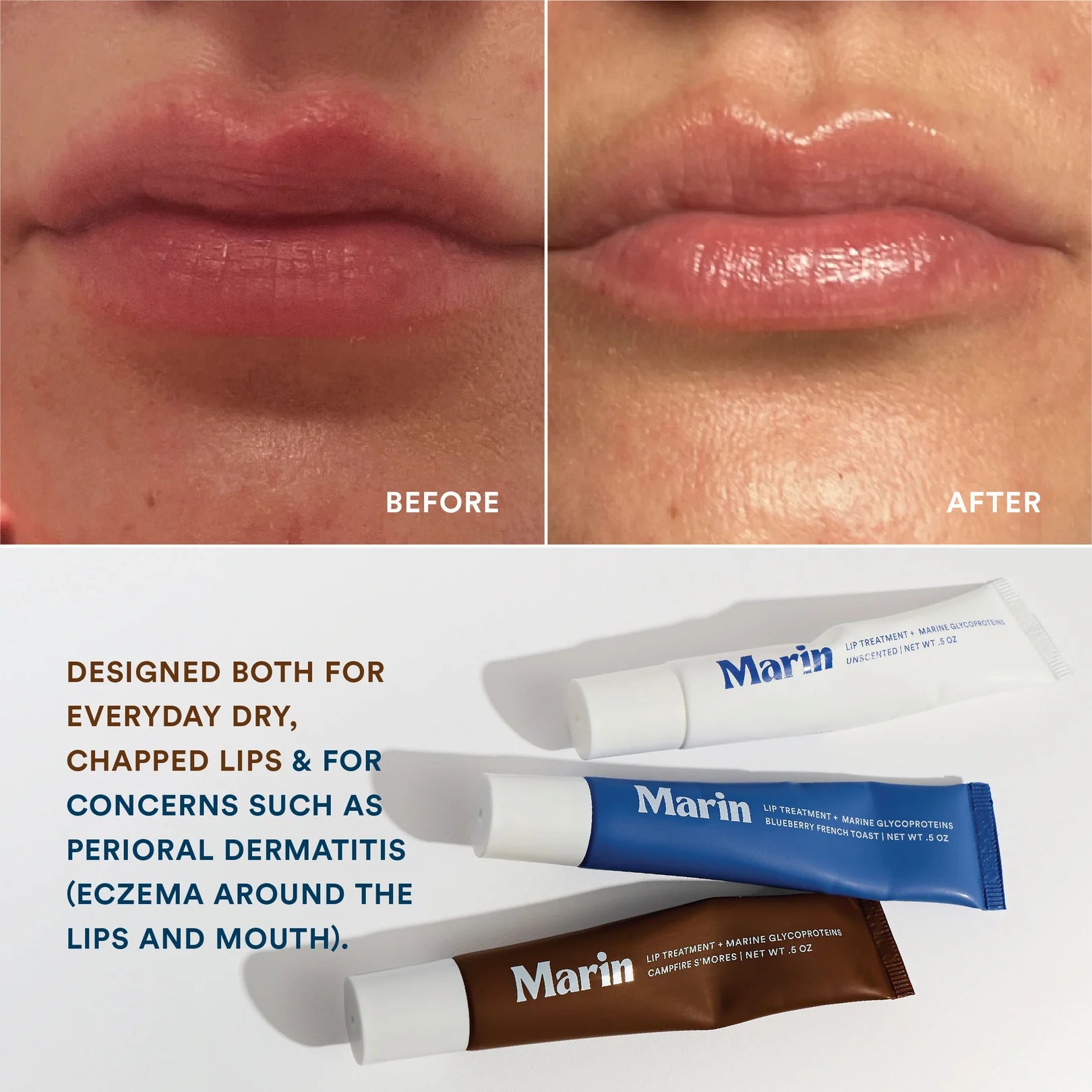 Marin Lip Treatment